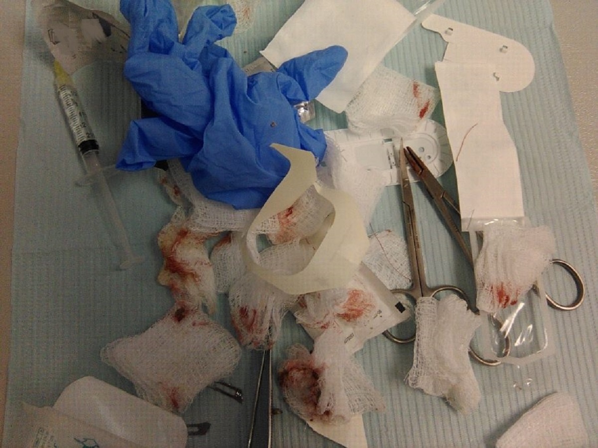 13-YEAR-OLD BOY SHOT IN CHEST WITH GLOCK GHOST GUN