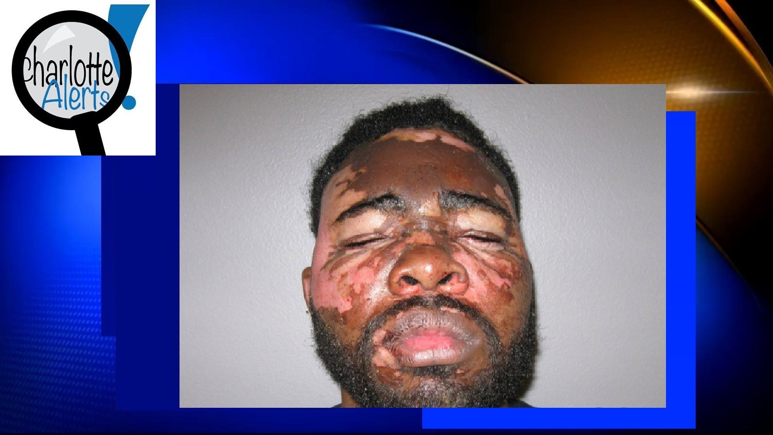 WOMAN THROWS HOT GREASE ON BLACK MAN DURING ALLEGED BURGLARY
