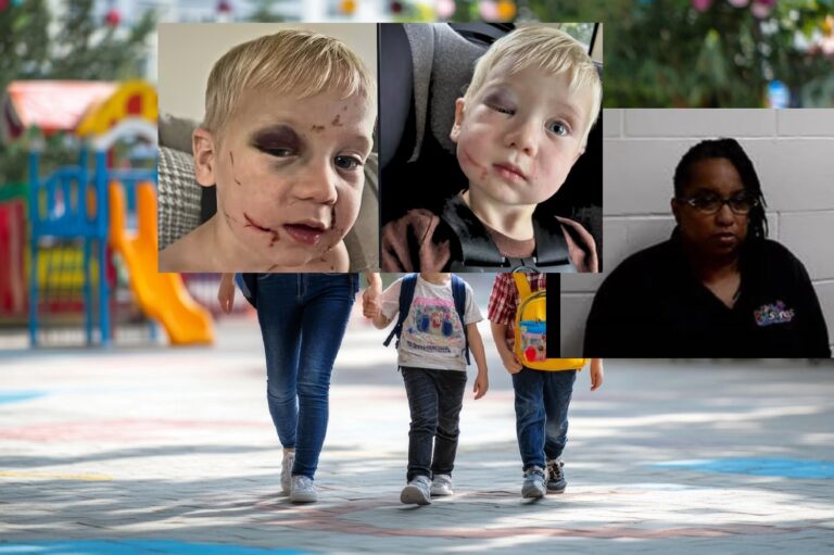 YOUNG KID ABUSED AT DAYCARE