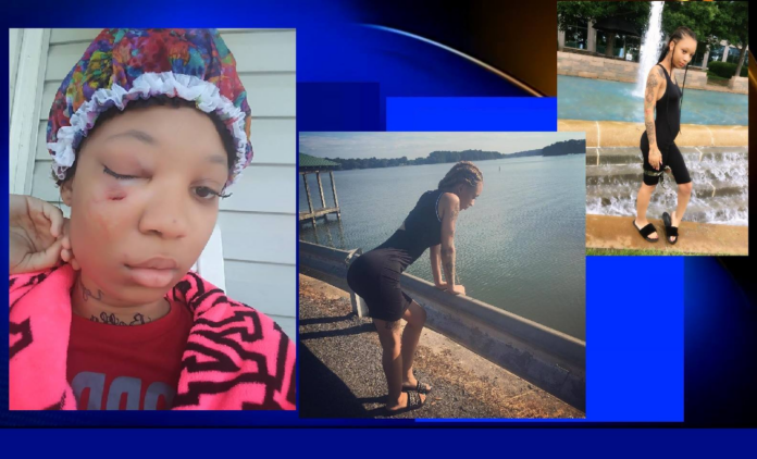 WOMAN ASSAULTED BY MAN IN CHARLOTTE