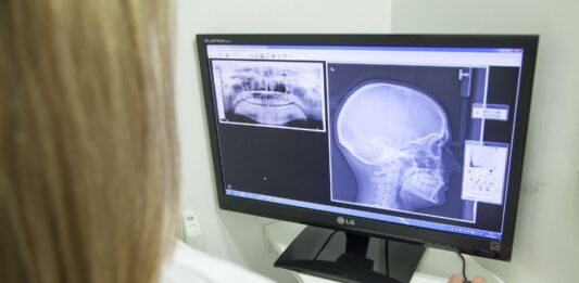 atrium health hospital lawsuit sued malpractice negligence