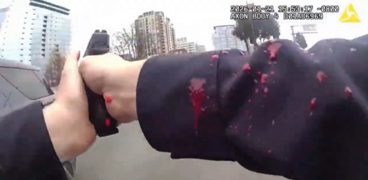 VIDEO COP SHOT IN HEAD