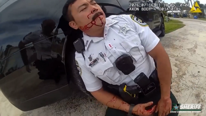VIDEO: 2 COPS SHOT IN FACE DURING SHOOTOUT WITH MAN, COPS HAD TO BE AIRLIFTED TO HOSPITAL