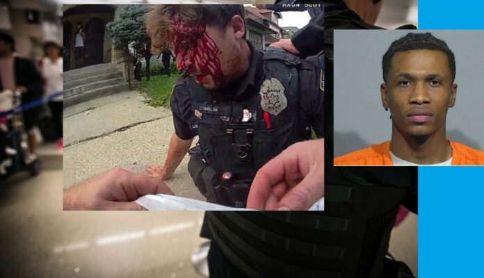 COP GETS BEAT WITH HIS OWN DUTY GUN BY SUSPECT, COP ADMITS TO SEEING STARS AND BEING DIZZY
